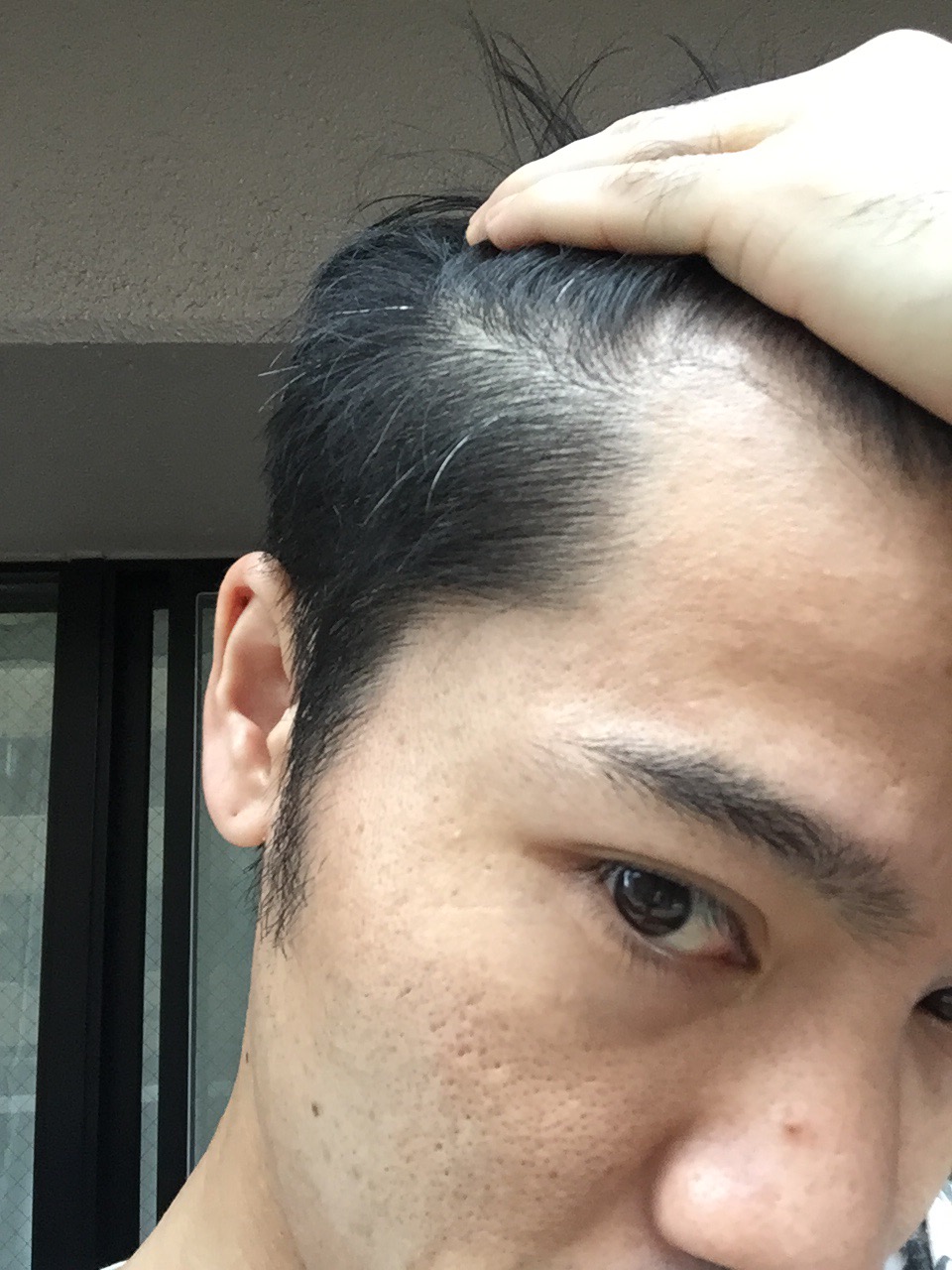 白髪は抜かないでください。なぜなら… | F BRAND(エフブランド)【福岡〈中央区天神・今泉・北九州(小倉)・西区橋本〉の美容室